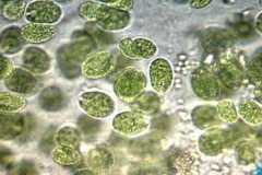 Gallerthüllen-Grünalge - Gloeocystis ampla