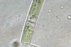 Schnurgrünalge - Chlorhormidium sp.