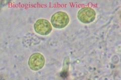 Wasser-Grünalge - Chlorococcum sp.