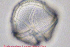 Panzertafelflagellat - Peridinium sp.