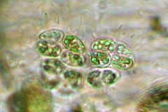 Viersporenalge - Tetraspora sp.