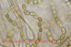 Ringelalge - Anabaena sp.