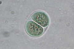 Teich-Kugelblaualge - Chroococcus limneticus