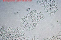 Netzblaualge - Microcystis sp.