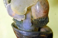 Süßwasserlungenschnecke - Radix sp.