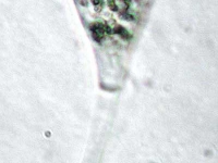 Glockentierchen - Vorticella