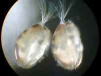 Muschelkrebse - Ostracoda