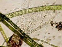 Rädertierchen - Staphanoceros fimbriatus